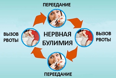 Лечение булимии в Касимове